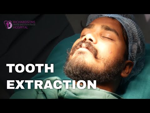Just Had Teeth Extracted
