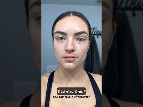 How my face changed with 8 days no alcohol #dryjanuary #sober #sobriety #shortsvideo #shorts