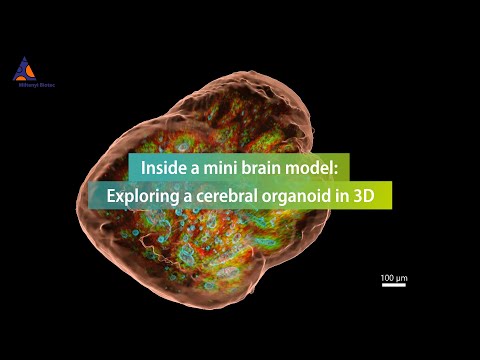 Inside a mini brain model: Exploring a cerebral organoid in 3D
