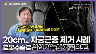 20cm의 자궁근종, 오히려 자궁근종이 크면 증상을 느끼기 어렵다? 로봇수술로 자궁적출 없이 깨끗한, 임신 가능한 자궁으로 만든 케이스