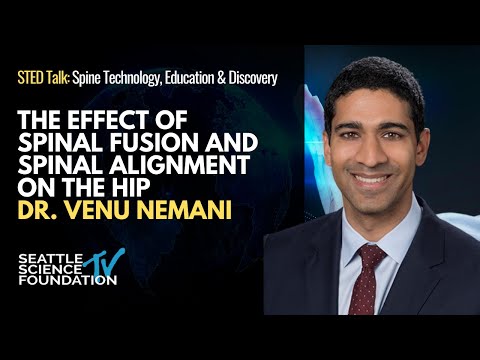 The Effect of Spinal Fusion and Spinal Alignment on the Hip - Dr. Venu Nemani