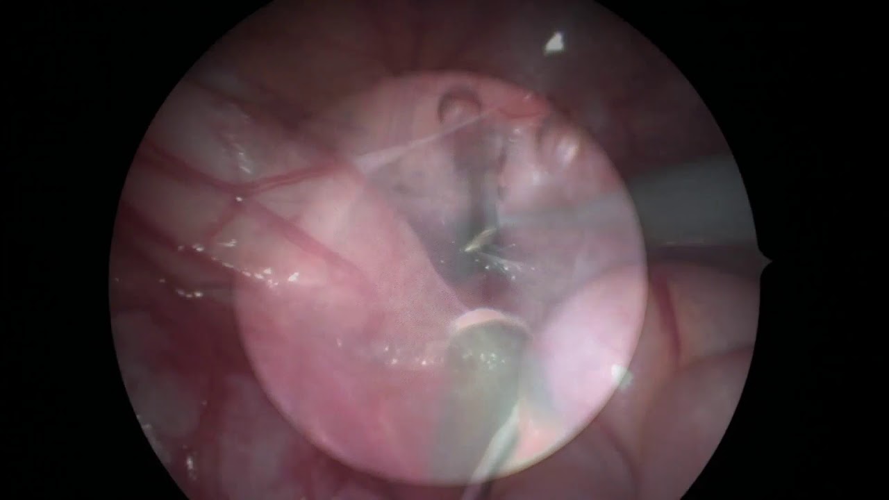 Daniel Cabezali Barbancho-25