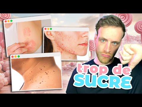 11 signes que tu manges TROP DE SUCRE