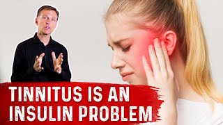 Tinnitus "Ringing in the Ears" is an Insulin Problem – Dr. Berg