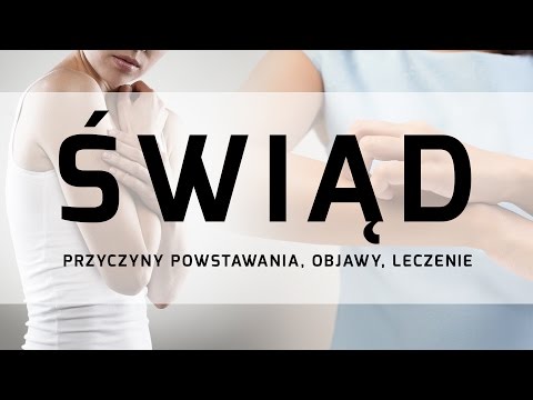 Palucha krasnodare opona Płasko-koślawe zniekształcenie stóp dziecka w siłowni
