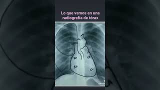 Qué vemos en una radiografía de tórax #Shorts