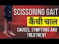 कैँची चाल Scissor Gait Explained In Hindi Causes Treatment Of Scissoring Gait Cp Chi