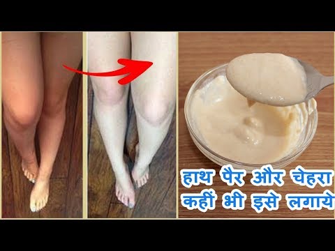 download lagu mp3 mp4 Gori Skin, download lagu Gori Skin gratis, unduh video klip Gori Skin