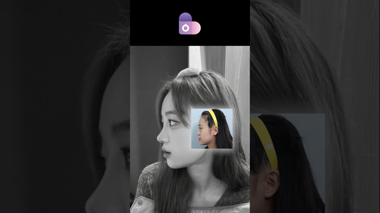 성형하는 이유 #shorts #성형전후