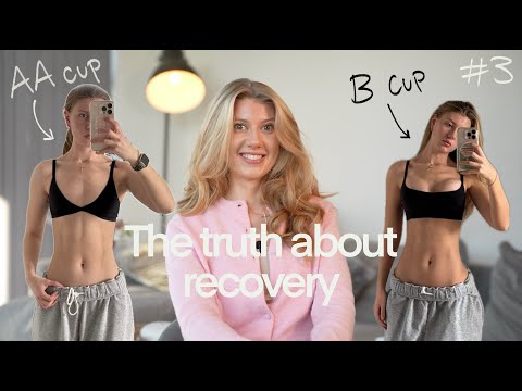 The reality of recovering from a boob job - full 6 week recovery!