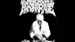 Dysmenorrheic Hemorrhage - They're All Dead on the Inside