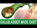 Gallbladder: Cholelithiasis vs Cholecystitis vs Choledocholithiasis vs Cholangitis [Made Easy]