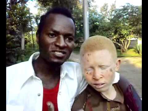 Arusha: Educating society on albinos issue