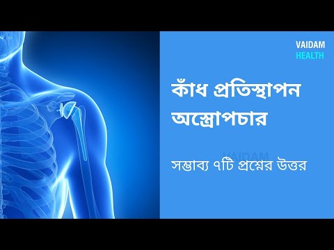 কাঁধ প্রতিস্থাপন- প্রায়শই জিজ্ঞাসিত প্রশ্ন