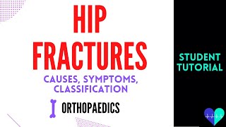 Hip Fractures (causes, symptoms & classification) - Medical Tutorial