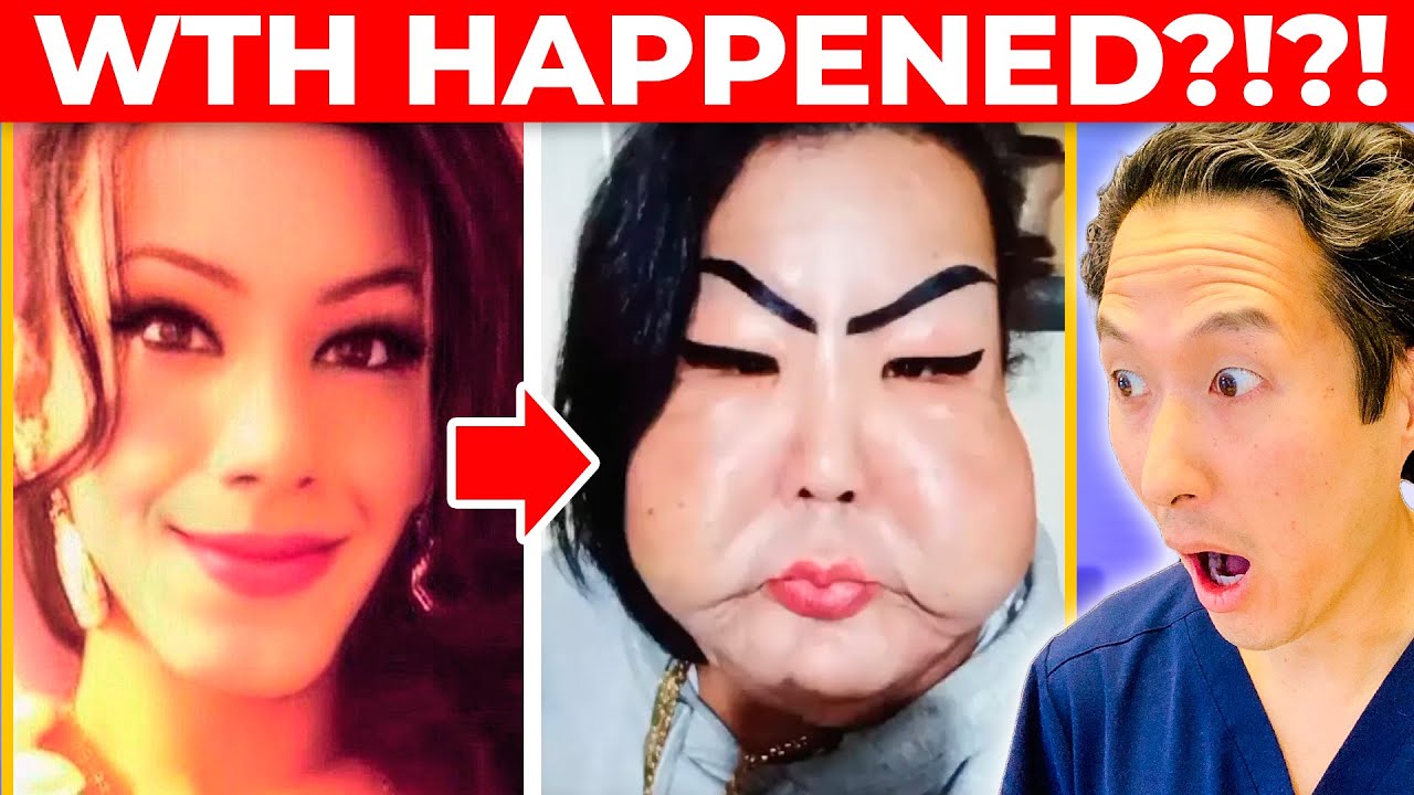 Plastic Surgeon Reveals Botched Surgery Gone WILD! JUJU DO PIX! Extreme Bodies Explained!
