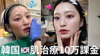 【韓国肌治療】10万円かけて肌治療してきたら大後悔した