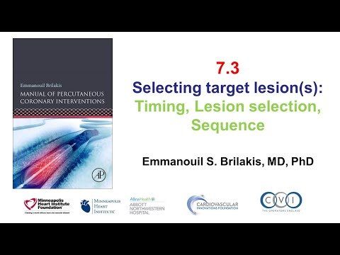 7.3 Manual of PCI - PCI timing, lesion selection, sequence