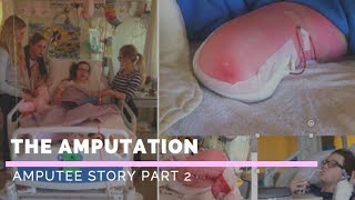I HAVE MY LIFE BACK | amputee story part  2 | Elke Lale