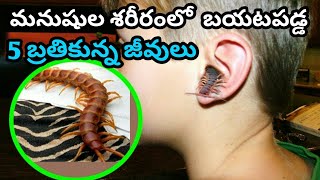 Top 5 Living creatures found on body | bmc facts | Telugu video