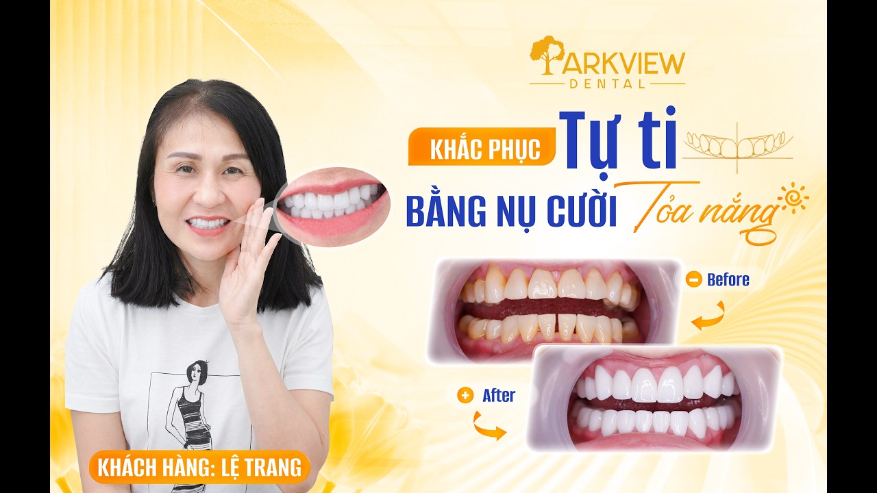 Khách Hàng Trang Lê Chia Sẻ Trải Nghiệm Khi Được Người Nhà Giới Thiệu