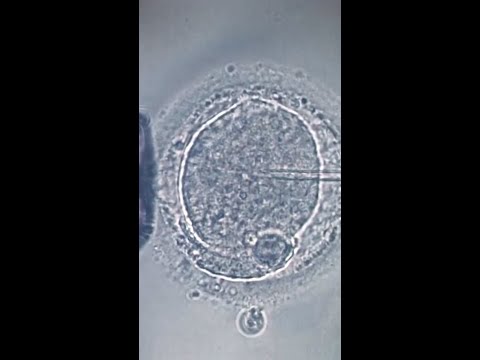 Florida couple sues after IVF mix-up