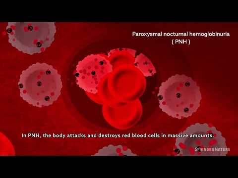 Hemolytic processes in PNH and its treatment: intravascular and extravascular hemolysis