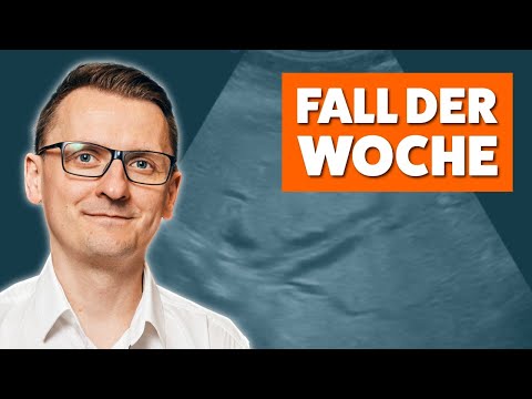 Pathologischer DHC und Cholestase: So triffst du die richtigen Entscheidungen - Fall der Woche