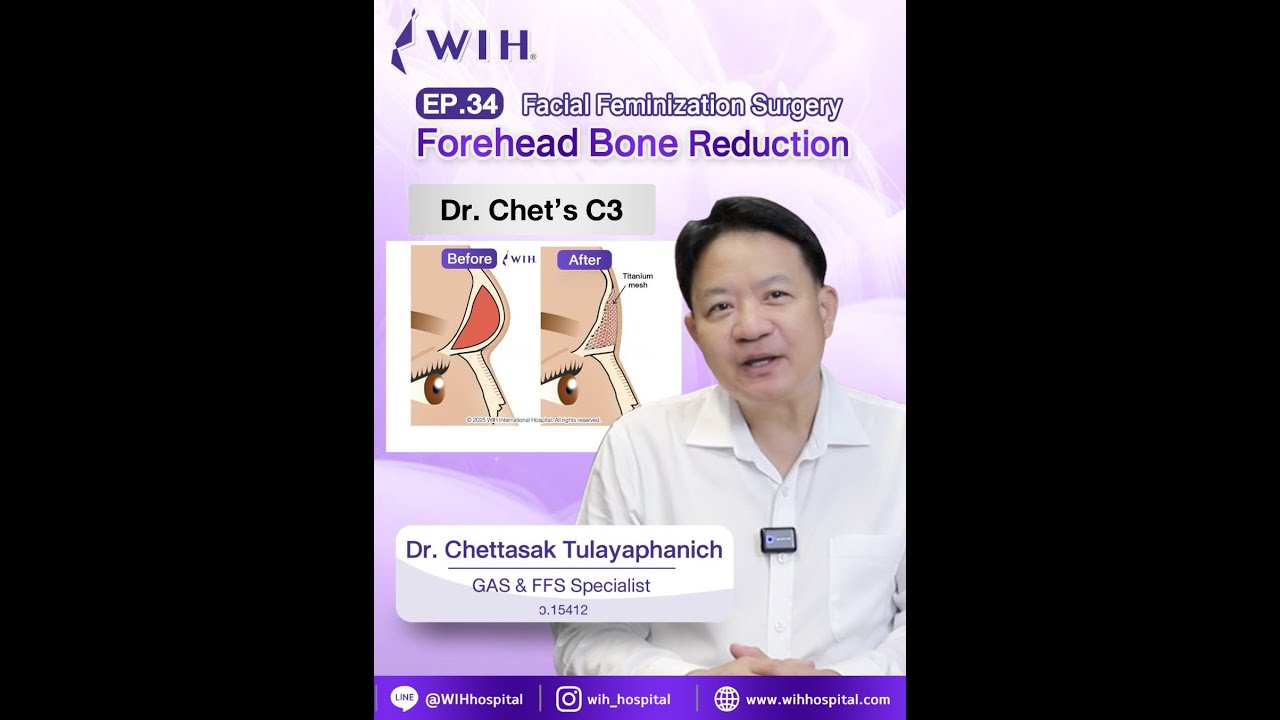 EP.34 | Dr. Chettasak’s Brow Ridge Bone Contouring Techniques