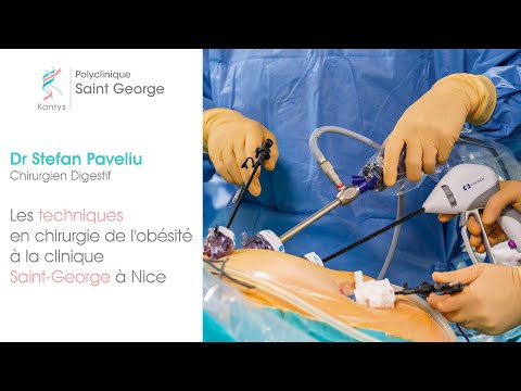 Les techniques en chirurgie bariatrique à la clinique Saint-George à Nice