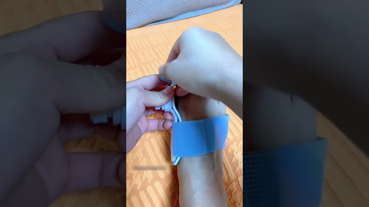 How to Correct Toe Deformity at Home  ▶️Adjustable Foot Care Big Toe Straightener Review