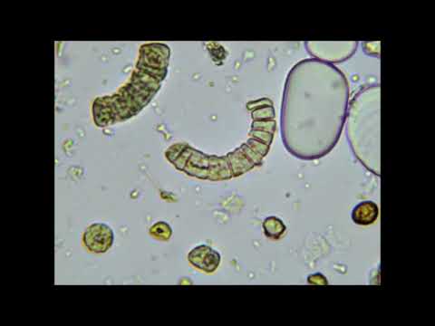 Cyanobacteria and the transition between the primordial and present atmosphere.