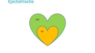 Wat is hartfalen? Cardioloog dr. Hans Post van het Catharina Hart- en Vaatcentrum geeft antwoord