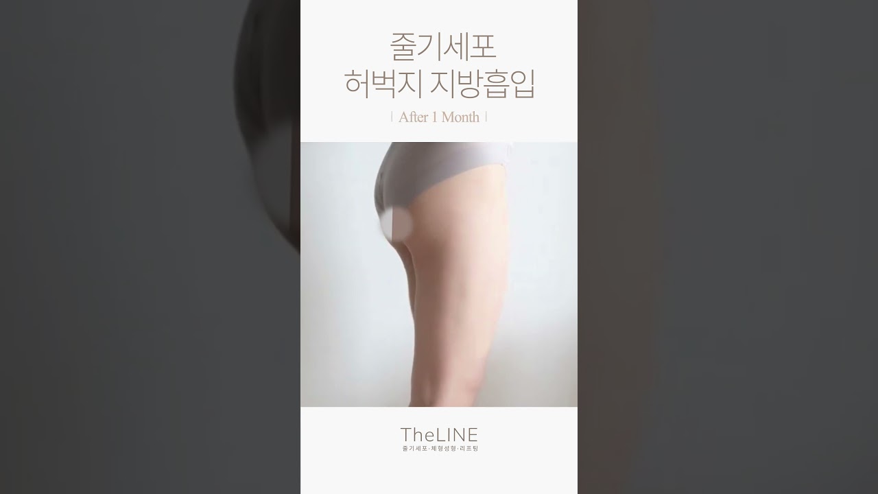 더라인 쇼츠 영상