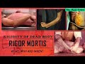 Rigor Mortis - Rigidity of the Dead Body | Early Changes | Thanatology | You Must Know