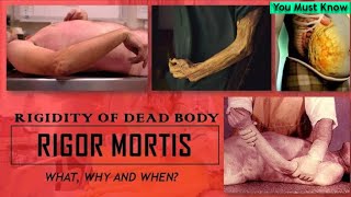 Rigor Mortis - Rigidity of the Dead Body | Early Changes | Thanatology | You Must Know