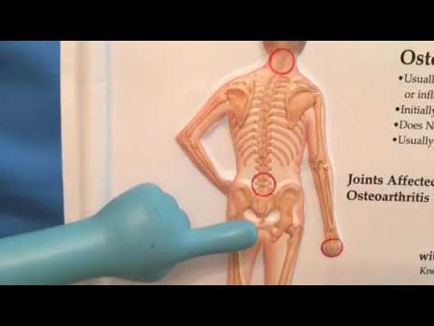 Clenbuterol paglalarawan slimming Bumili ng kaliskis sobra sa timbang