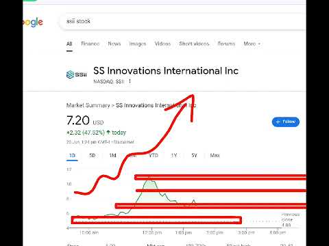 SS Innovations International, ssii stock analysis buy or sell