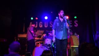 Augustines- tenement teeth (pela)