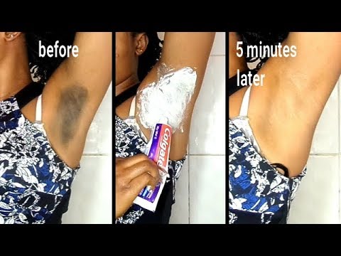 Comprare la crema di decolorazione di faccia cinese da pigmentary nota in una farmacia Crema da abbronzatura e da posti di pigmentary