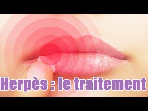 comment soigner bouton d'herpes sur la levre