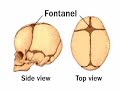 Baby's soft spots (fontanels)