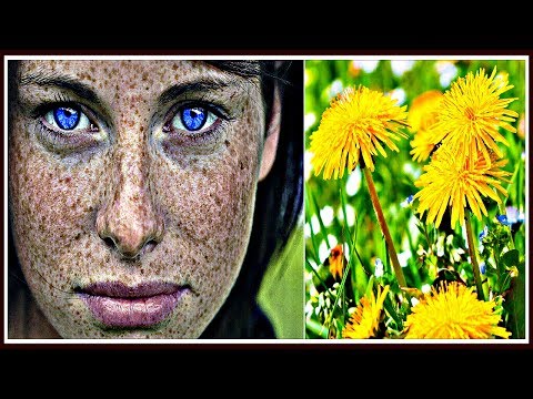 Форум удаляем пигментные пятна Как делать макияж при веснушках