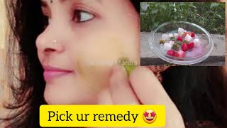 pick your remedy n say goodbye to all skin problems|summer tips|telugu with english subtitles #rekha