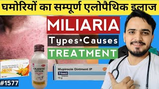 Download lagu क्या आप भी घमोरिया से परेशान हो? mp3
