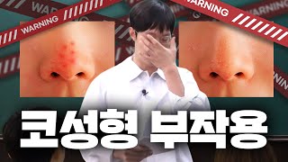 코성형 강의 12편 - 코 성형 부작용