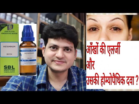 Eye allergy eye itching homeopathic medicine for allergic co...