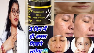 Heaven Magic Bridal Super Powerful Face Cream Honest Review | 2024 | Bridal Face Cream Review Hindi