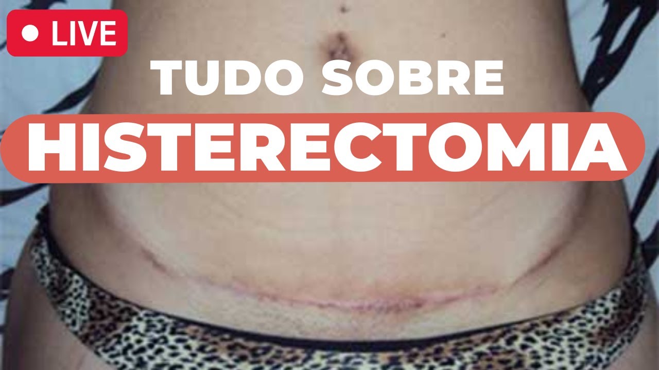 HISTERECTOMIA: CIRURGIA PARA RETIRAR O ÚTERO.