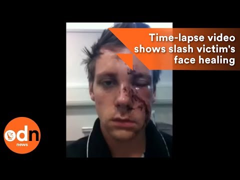 download lagu mp3 mp4 Acid Bandage Road Rage, download mp3 Acid Bandage Road Rage free downloadn, video klip Acid Bandage Road Rage